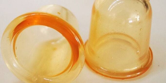 Banks for the treatment of prostatitis