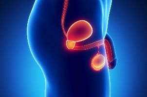 Inflammation of the prostate gland